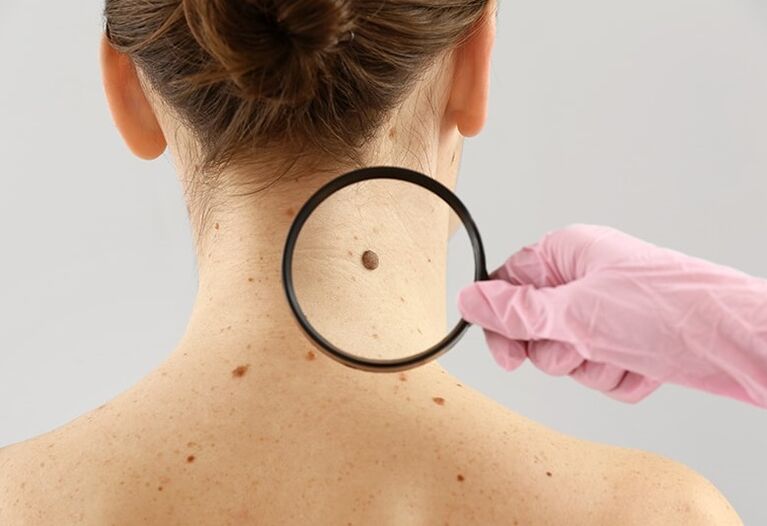 Keramiin aitab lahendada nahaprobleeme