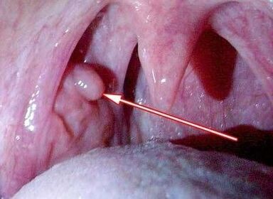 Papilloom kurgus